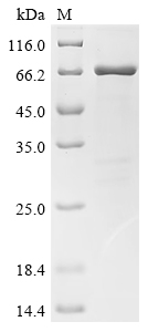 Recombinant Human Islet cell autoantigen 1 (ICA1)