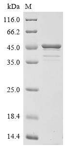 Recombinant Anisakis simplex Tropomyosin