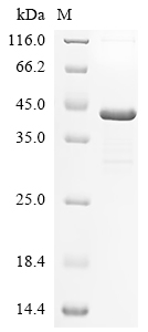 Recombinant Human herpesvirus 1 Capsid vertex component 2 (CVC2), partial