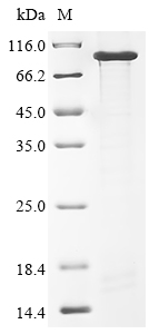 Recombinant Mouse Neural cell adhesion molecule 1 (Ncam1), partial