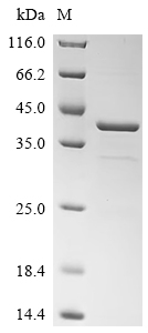 Recombinant Human herpesvirus 1 Triplex capsid protein 2 (TRX2)