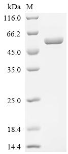 Recombinant Human Tumor necrosis factor ligand superfamily member 9 (TNFSF9), partial, Biotinylated