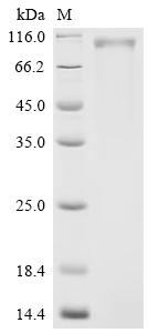 Recombinant Human Receptor tyrosine-protein kinase erbB-2 (ERBB2) (S310Y), partial