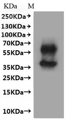 Recombinant Mouse B-lymphocyte antigen CD20 (Ms4a1)-VLPs