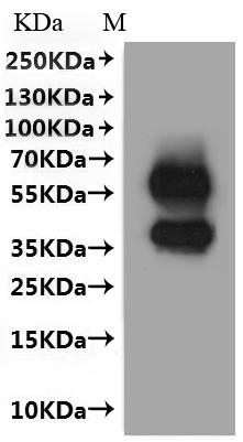 Recombinant Rat Membrane spanning 4-domains A1 (Ms4a1)-VLPs