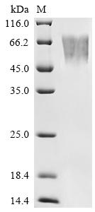 Recombinant Human Fractalkine (CX3CL1), partial, Biotinylated