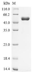 Recombinant Human Thymic stromal lymphopoietin (TSLP) (R127A,R130A)