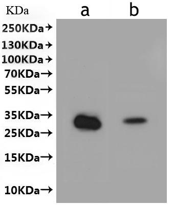 Recombinant Human HLA-DRB1&HLA-DRA Heterodimer Protein-VLPs