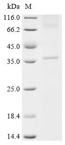 Recombinant Human Type-2 angiotensin II receptor (AGTR2)