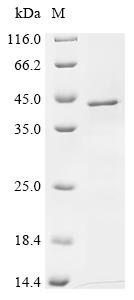 Recombinant Human Synaptophysin (SYP)