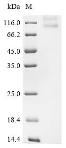 Recombinant Human Potassium voltage-gated channel subfamily KQT member 1 (KCNQ1)