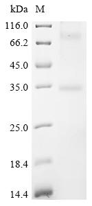 Recombinant Human Olfactory receptor 52D1 (OR52D1)