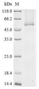 Recombinant Human UDP-glucuronosyltransferase 1A5 (UGT1A5)