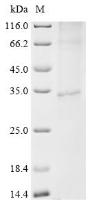 Recombinant Human G-protein coupled bile acid receptor 1 (GPBAR1)