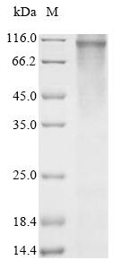 Recombinant Human Wolframin (WFS1)