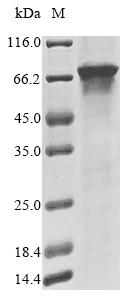 Recombinant Human Terminal nucleotidyltransferase 4A (TENT4A), partial
