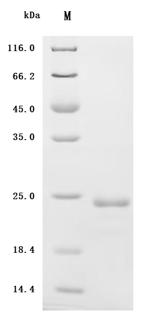 Recombinant Human Interleukin-6 (IL6) Protein (Active)