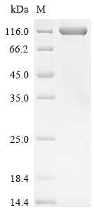 Recombinant Human Neuropilin-1 (NRP1) (V179A)