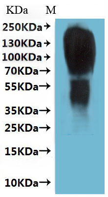 Recombinant Human Type-2 angiotensin II receptor (AGTR2)-VLPs