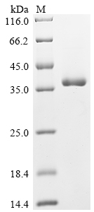 Recombinant Cowpox virus CPXV199 protein (CPXV199), partial