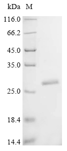 Recombinant Human Lysine-specific demethylase 6B (KDM6B), partial