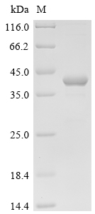 Recombinant Human Cyclin-G-associated kinase (GAK), partial