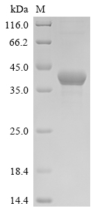 Recombinant Escherichia coli DNA adenine methylase (dam)