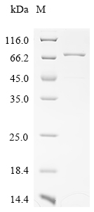 Recombinant Human Creatine kinase M-type (CKM)