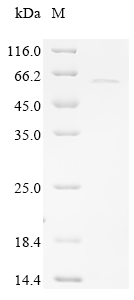 Recombinant Human Sarcoplasmic/endoplasmic reticulum calcium ATPase 2 (ATP2A2), partial