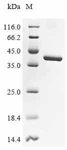 Recombinant Mouse Lys-63-specific deubiquitinase BRCC36 (Brcc3)