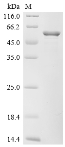 Recombinant Proteus mirabilis Serralysin (zapA)