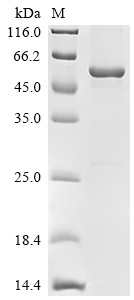 Recombinant Human Cyclin-G-associated kinase (GAK), partial, Biotinylated