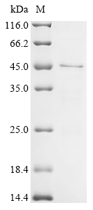Recombinant Human RAD51-associated protein 1 (RAD51AP1)