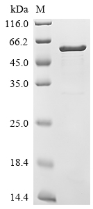Recombinant Mouse Troponin T, cardiac muscle (Tnnt2)