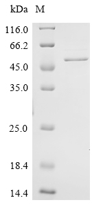 Recombinant Human Kelch domain-containing protein 3 (KLHDC3)