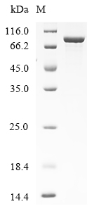 Recombinant Human Endogenous retrovirus group K member 113 Gag polyprotein (HERVK_113)