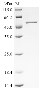 Recombinant Macaca fascicularis Paraneoplastic antigen Ma2 homolog (PNMA2)
