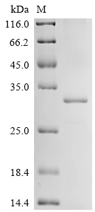 Recombinant Drosophila melanogaster Clathrin heavy chain (Chc), partial