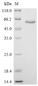 Recombinant Human Copper-transporting ATPase 2 (ATP7B), partial