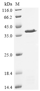 Recombinant Saccharomyces cerevisiae Actin-related protein 5 (ARP5), partial