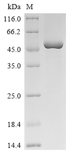 Recombinant Human Melanoma-associated antigen B3 (MAGEB3)