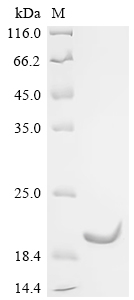 Recombinant Mouse Spectrin beta chain, non-erythrocytic 1 (Sptbn1), partial