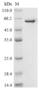 Recombinant Puumala virus Nucleoprotein (N)