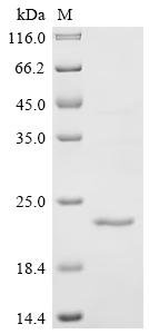 Recombinant Mouse C-C chemokine receptor-like 2 (Ccrl2), partial