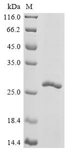 Recombinant Chapare mammarenavirus Pre-glycoprotein polyprotein GP complex (GPC), partial