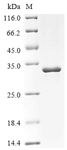 Recombinant Human tRNA (adenine (58)-N (1))-methyltransferase catalytic subunit TRMT61A (TRMT61A)