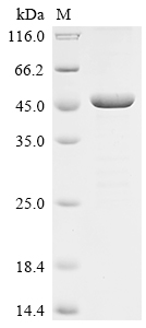 Recombinant Human Neutral cholesterol ester hydrolase 1 (NCEH1), partial