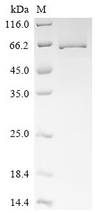 Recombinant Human Y-box-binding protein 2 (YBX2)