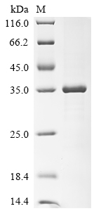 Recombinant Human ADP-ribosylation factor 1 (ARF1)