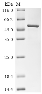 Recombinant Macaca fascicularis Paraneoplastic antigen Ma2 homolog (PNMA2)